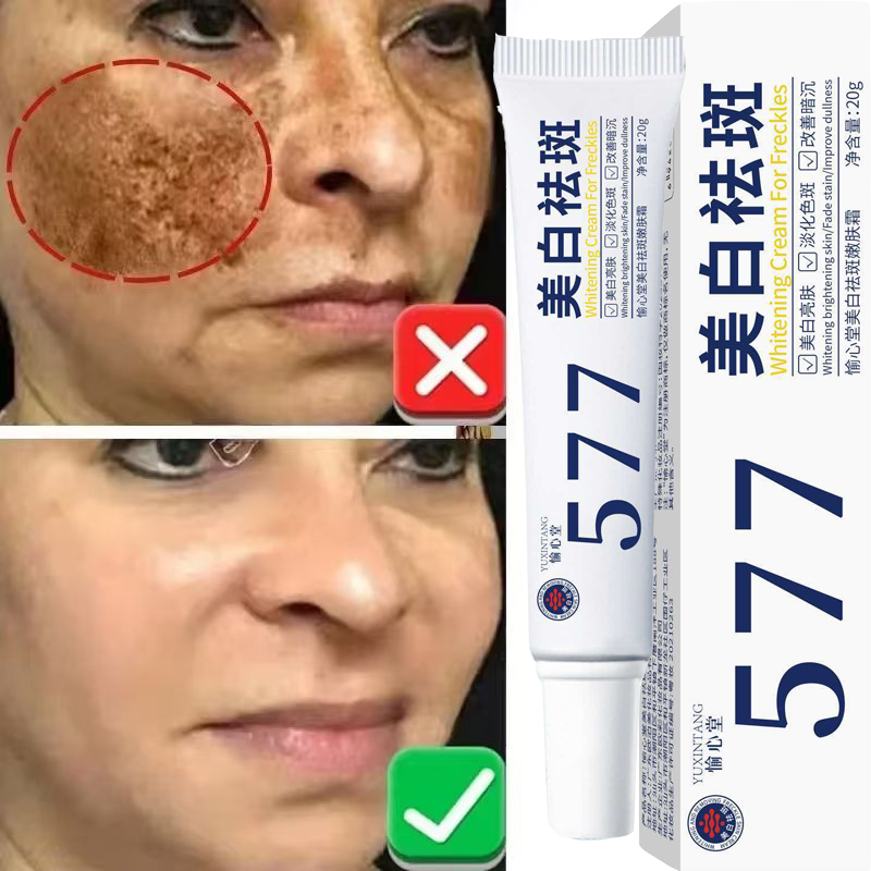 Korean Lifestyle Products - Whitening Freckle Cream Melasma Dark Spots