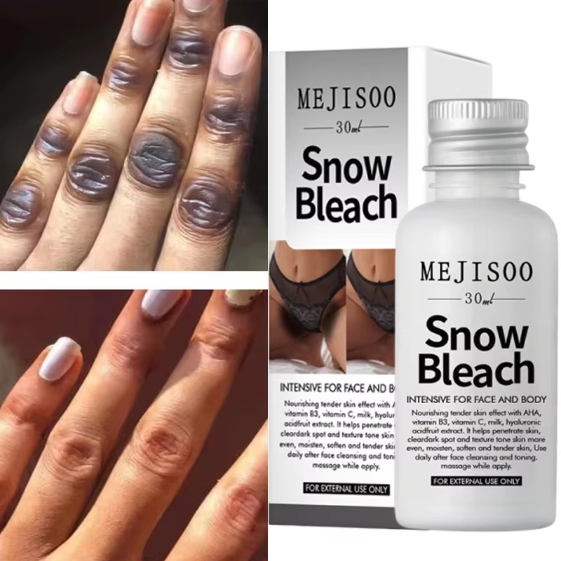 Fast Whitening Dark Knuckles B - Korean Lifestyle Products recension och pris