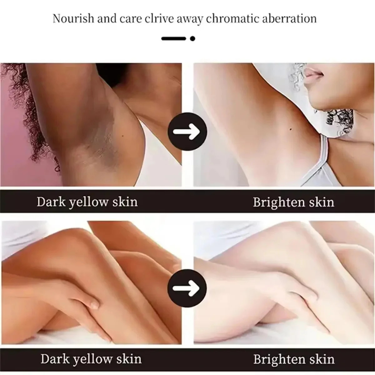 Fast Whitening Dark Knuckles B - Korean Lifestyle Products recension och pris