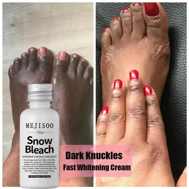 Fast Whitening Dark Knuckles B - Korean Lifestyle Products recension och pris