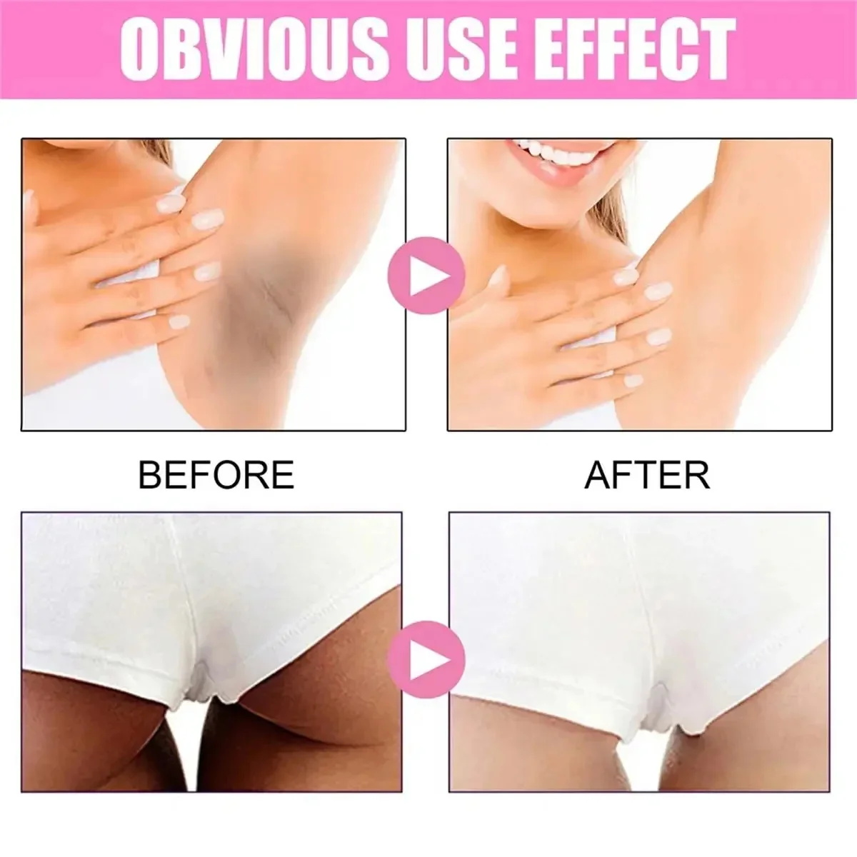 Fast Whitening Dark Knuckles B - Korean Lifestyle Products recension och pris