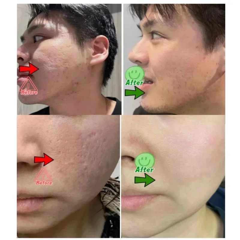 Salicylic Acid Pore Clearing C - Korean Lifestyle Products recension och pris
