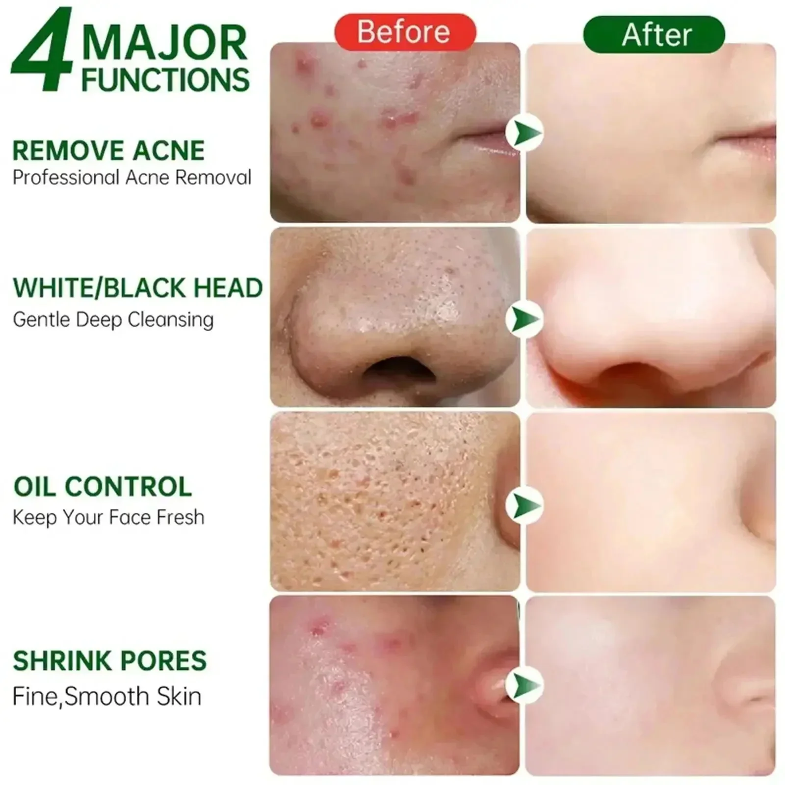 Salicylic Acid Pore Clearing C - Korean Lifestyle Products recension och pris