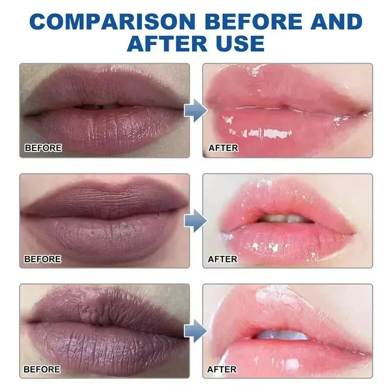 Remove Dark Lip Balm Fast Ligh - Korean Lifestyle Products recension och pris