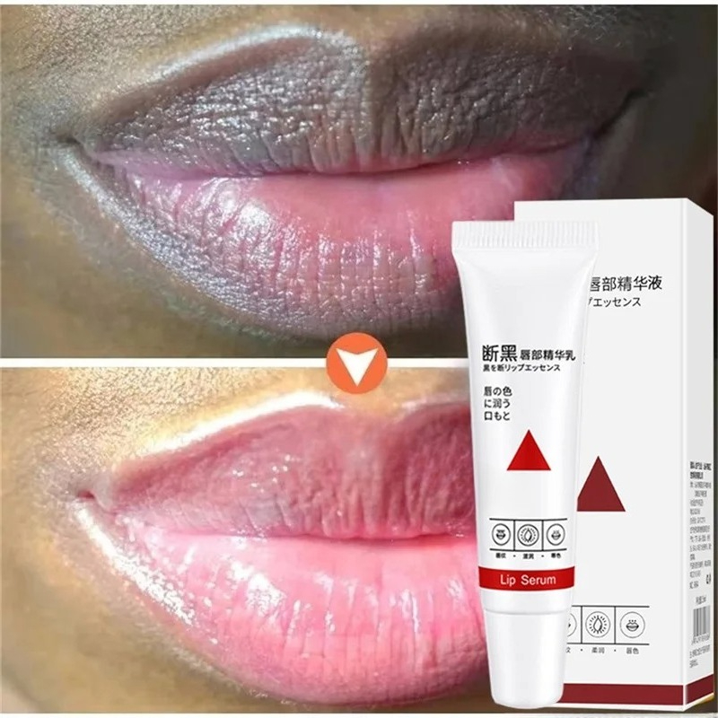 Remove Dark Lip Balm Fast Ligh - Korean Lifestyle Products recension och pris