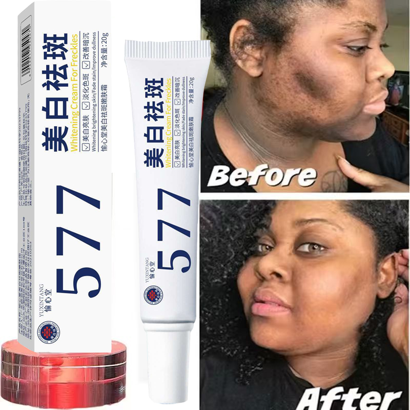 Whitening Freckle Cream Melasm - Korean Lifestyle Products recension och pris