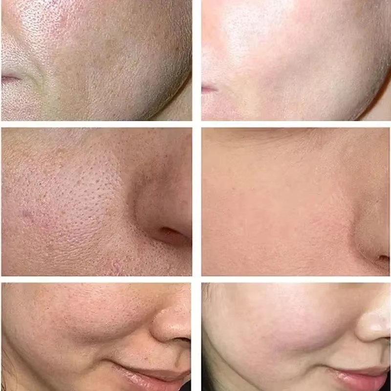 Salicylic Acid Pore Shrinking  - Korean Lifestyle Products recension och pris