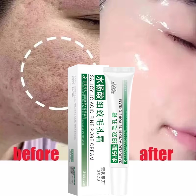 Salicylic Acid Pore Shrinking  - Korean Lifestyle Products recension och pris