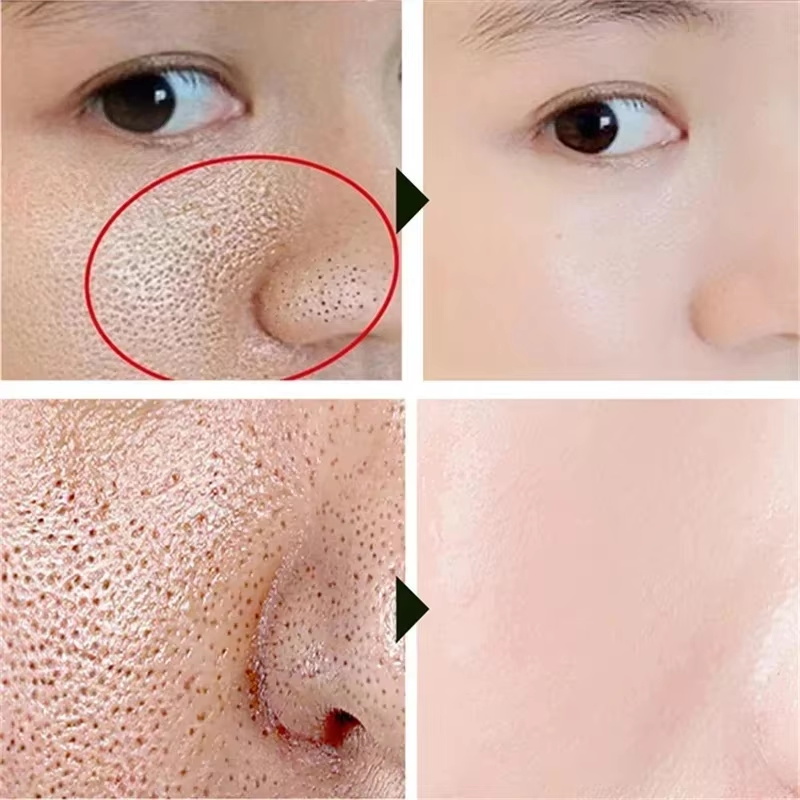 Salicylic Acid Pore Shrinking  - Korean Lifestyle Products recension och pris